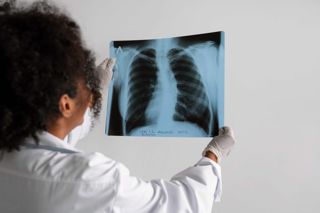 Cáncer de Mama y Pulmones