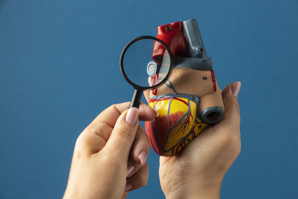 La Aorta
